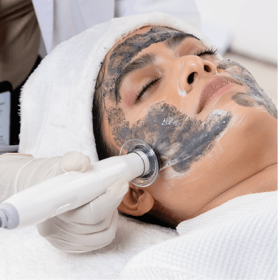 Charcoal Glow Bio-Hydra Facial Treatment