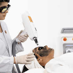 Bio Q Switched ND YAG Laser Treatment