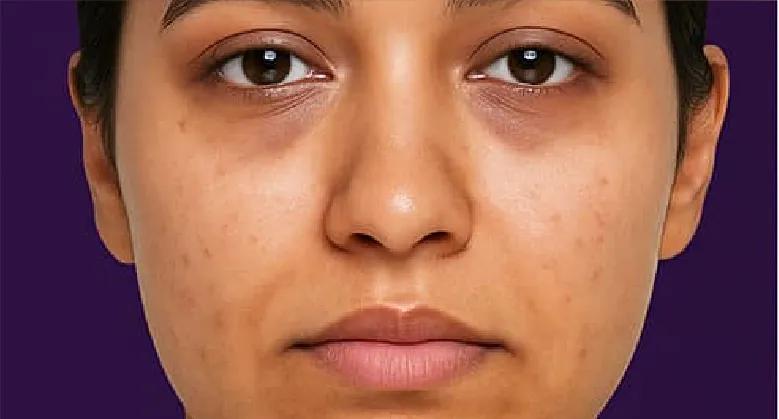 BioCare Brightening Aloe Vera Gel