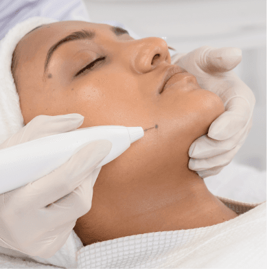 Mole, Skin Tag and Freckle Removal Treatment