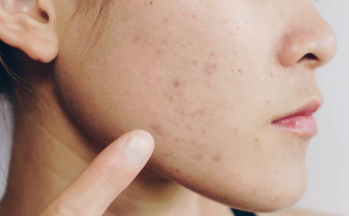 BioCare Handmade Niacinamide Brightening Beauty Bar