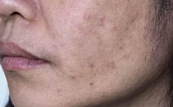 BioCare Exfoliation Face Serum