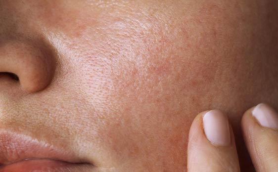 Novaclear Urban Sunblock For Oily & Combination Skin